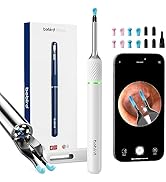 Ear Wax Removal Tool with 10 Megapixel Ear Camera, Note 5 Ear Wax Removal Kit with 12 Pcs Ear Sco...