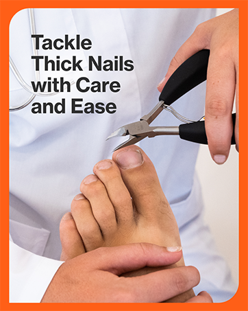 Professional Toenail Care