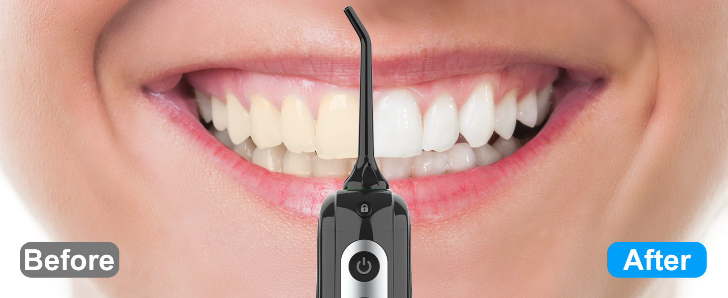 Cordless Water Dental Flosser