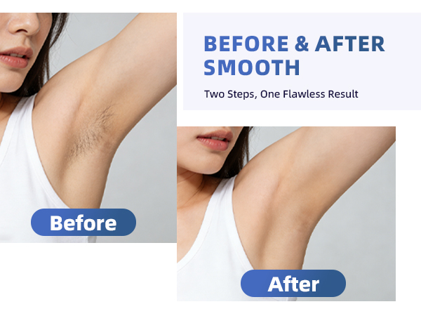 bikini trimmer