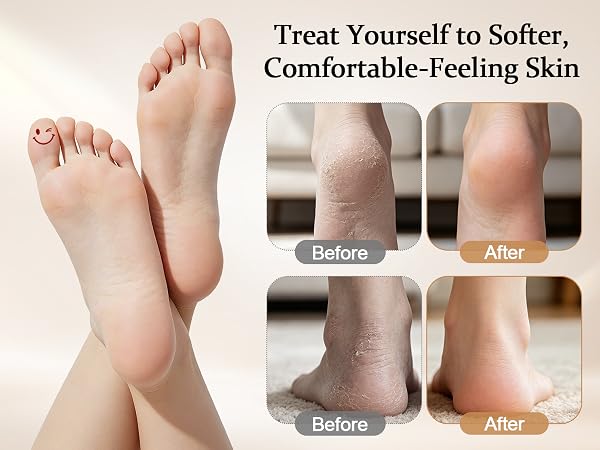 Treat Yourself to Softer, Comfortable-Feeling Skin
