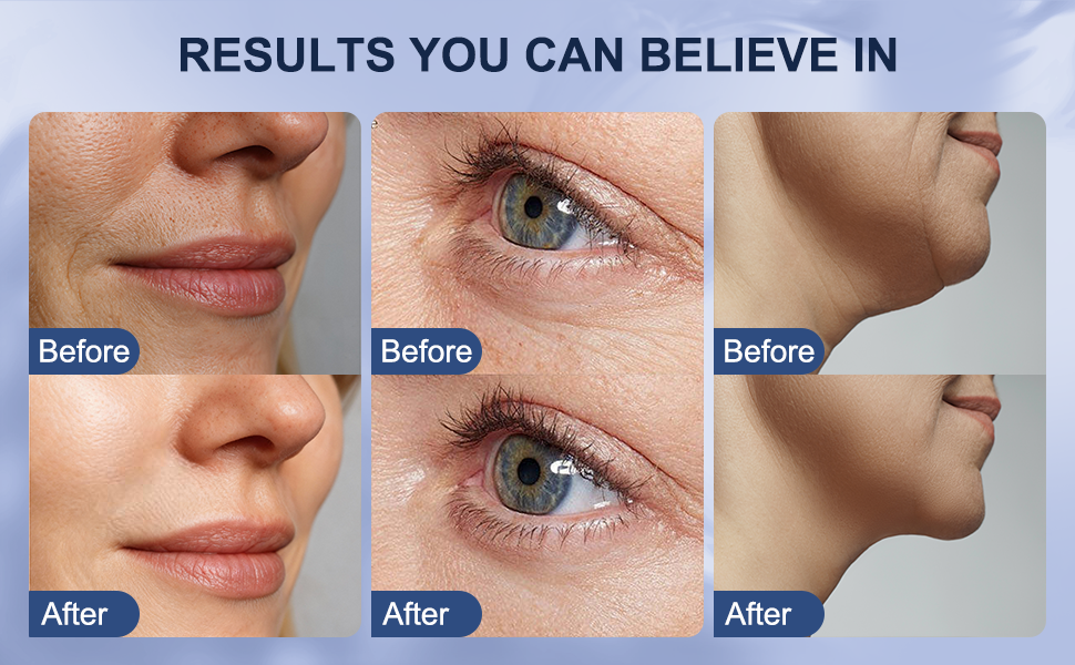 red light therapy for face