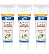 Earth's Care Acne Spot Treatment - 10% Sulfur Cream Medication to Clear Cystic Acne, Pimples and ...