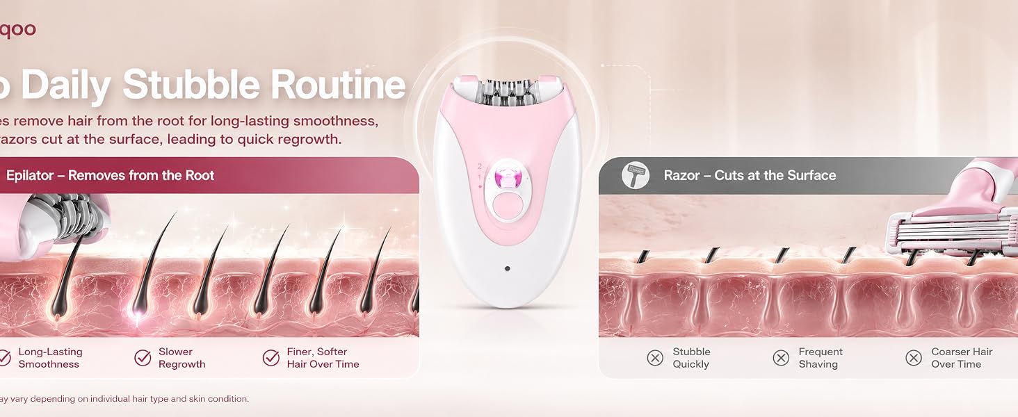 epilator