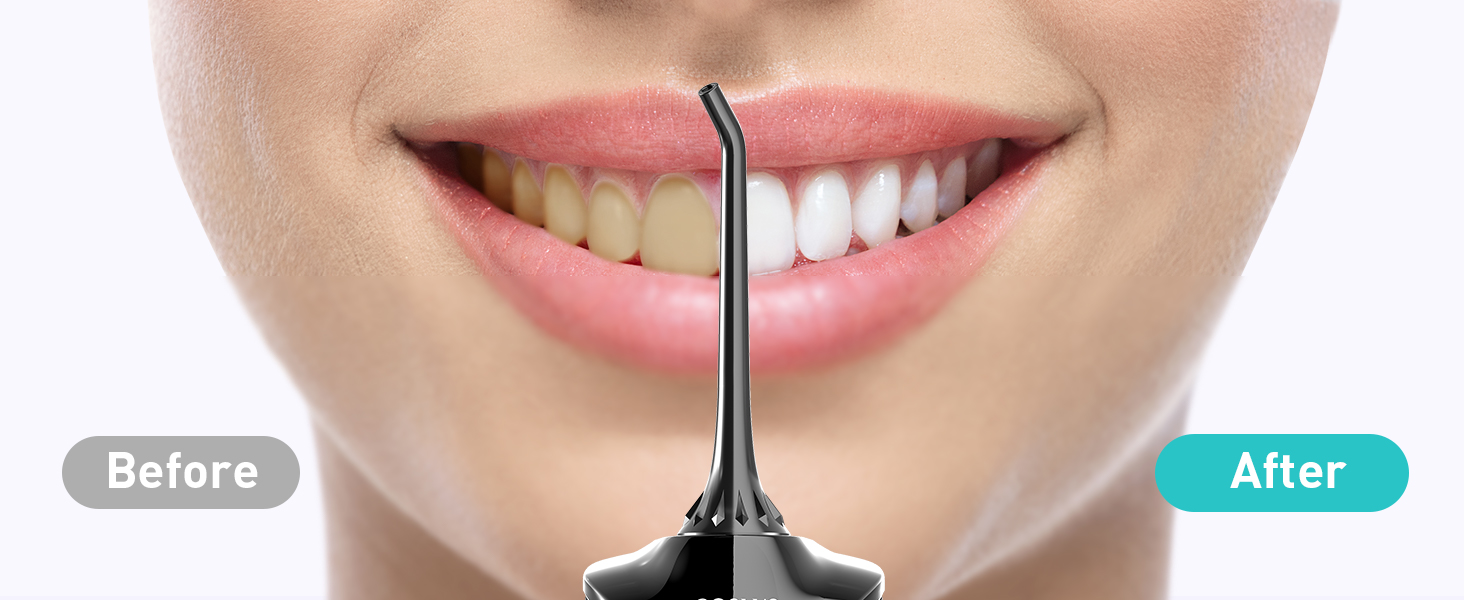 water dental flosser pick teeth cordlss portable Hilo dental con agua, recoge los dientes