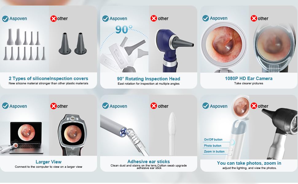 Otoscope