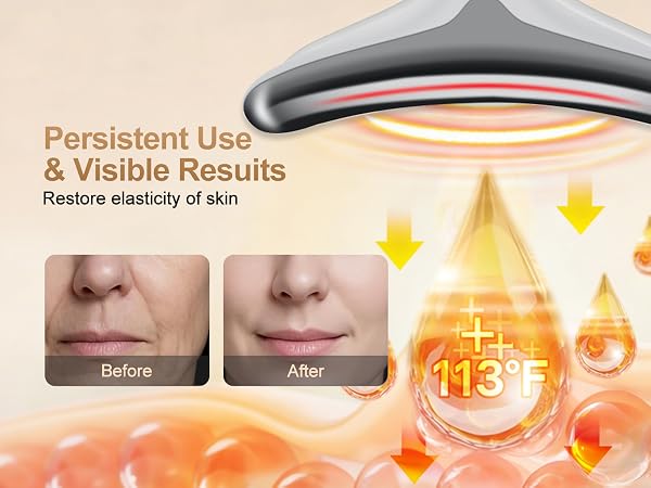 Facial Massager