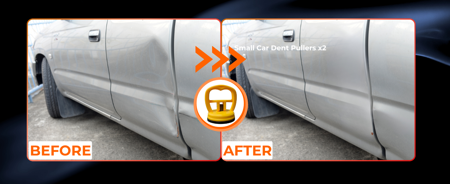 car dent puller