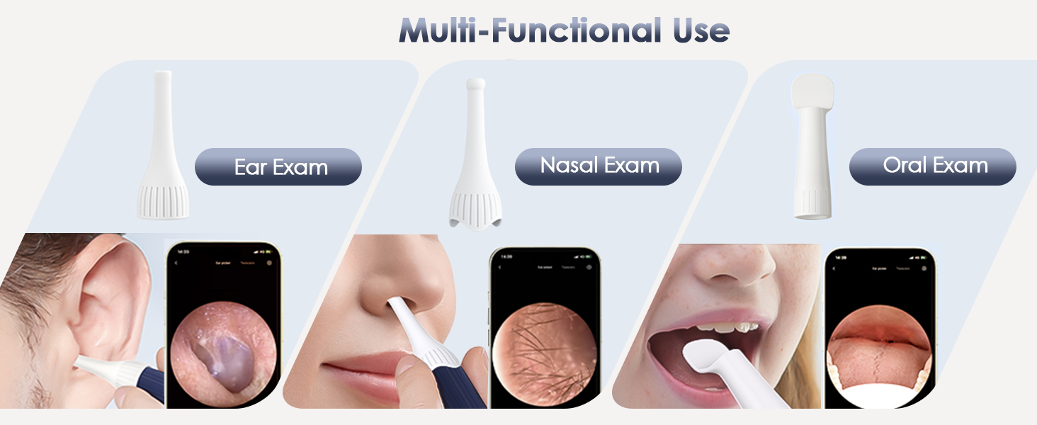 ear wax removal tool camera ear cleaner with camera earwax removal kit with camera ear cleaning kit