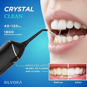 water flosser for teeth