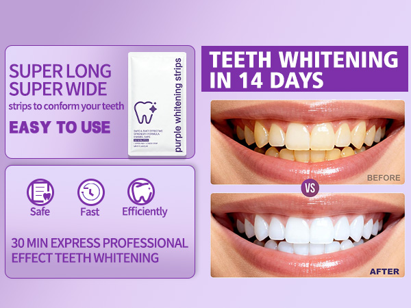 purple teeth whitening strips