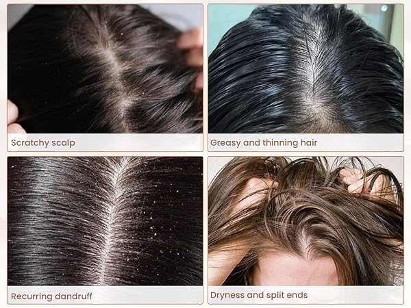 Scalp Comb
