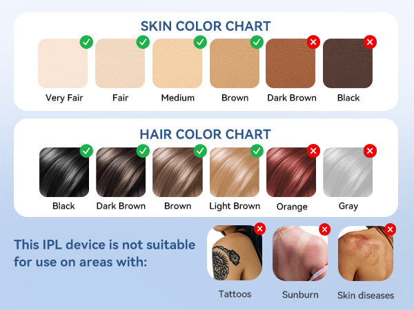 at home laser hair removal device