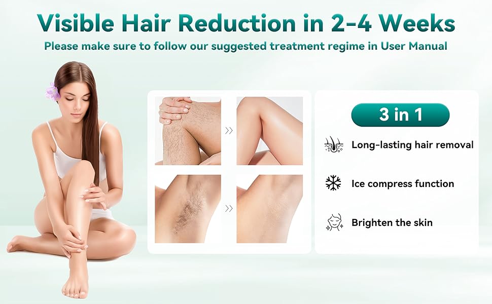 IPL laser hair removal