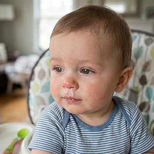 Baby runny nose