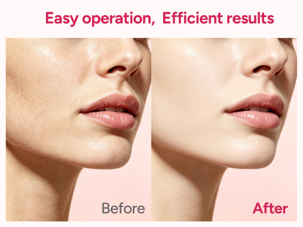 sonic dermaplaning tool for women