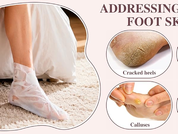 foot mask for dry cracked feet