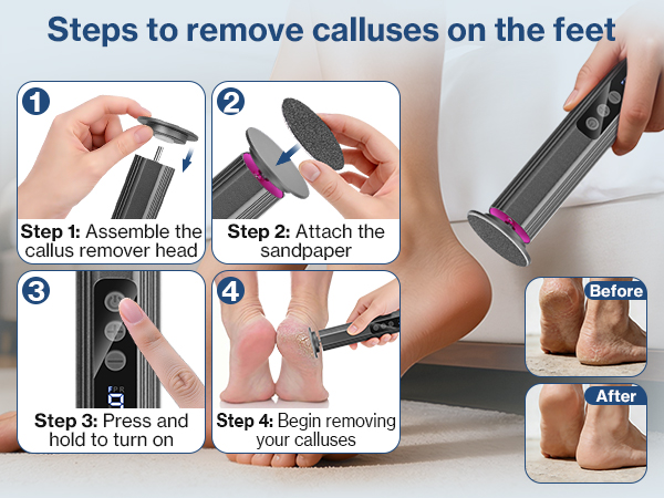 feet scrubber dead skin foot care foot file callus remover dead skin removal for feet pedicure tools