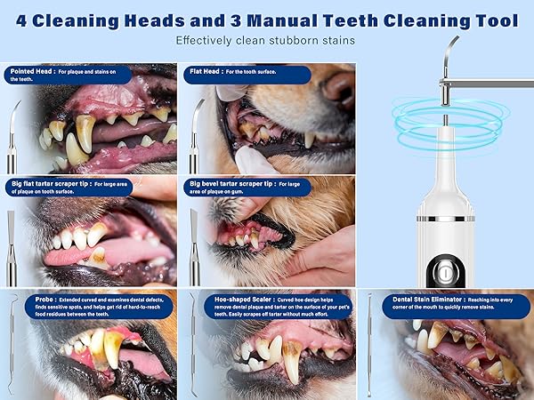ultrasonic tooth cleaner