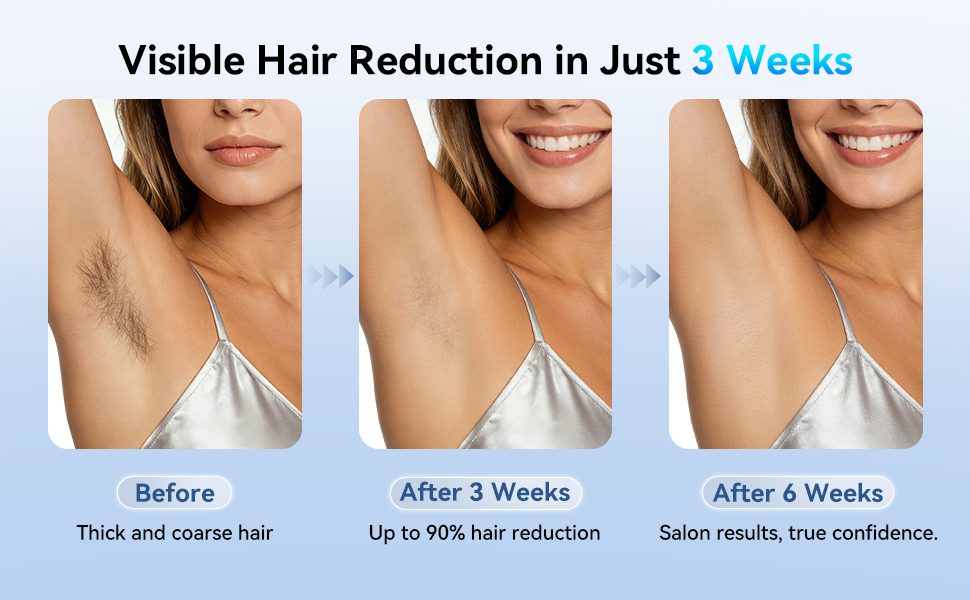 Visible Hair Reduction in Just 3 Weeks