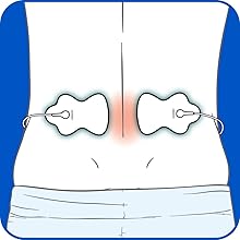 Omron TENS Pads