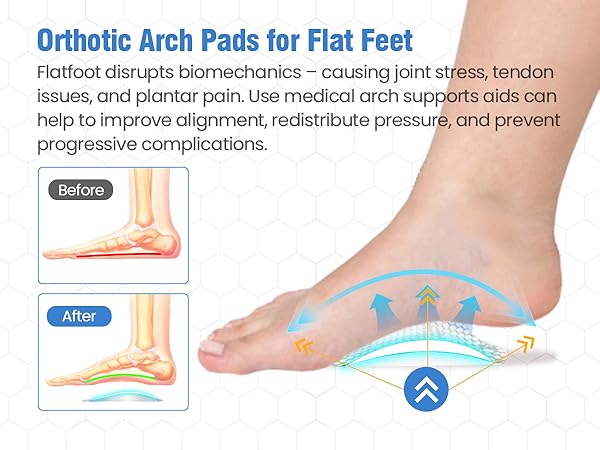 arch support inserts for women flat feet arch support flat foot arch support