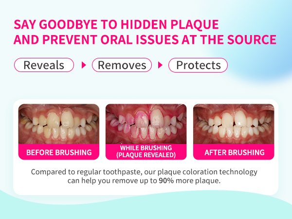 plaque remover for teeth