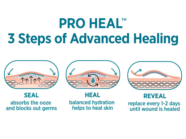 Advanced hydrocolloid gel pads support better healing by absorbing ooze &amp; blocking germs