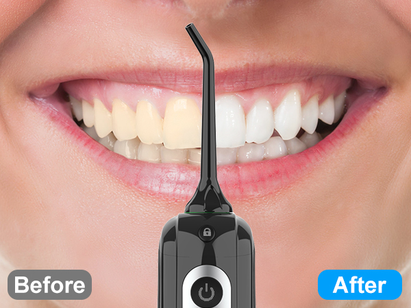Cordless Water Dental Flosser 