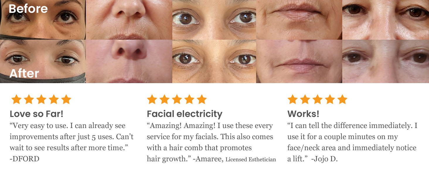 scscNuDerma Portable Handheld High Frequency Skin Therapy Wand Machine w/Neon – Anti-Aging 