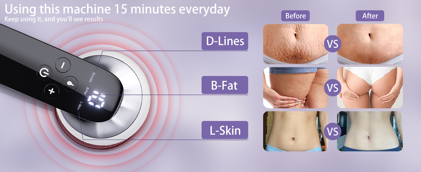 Body Sculpting Machine