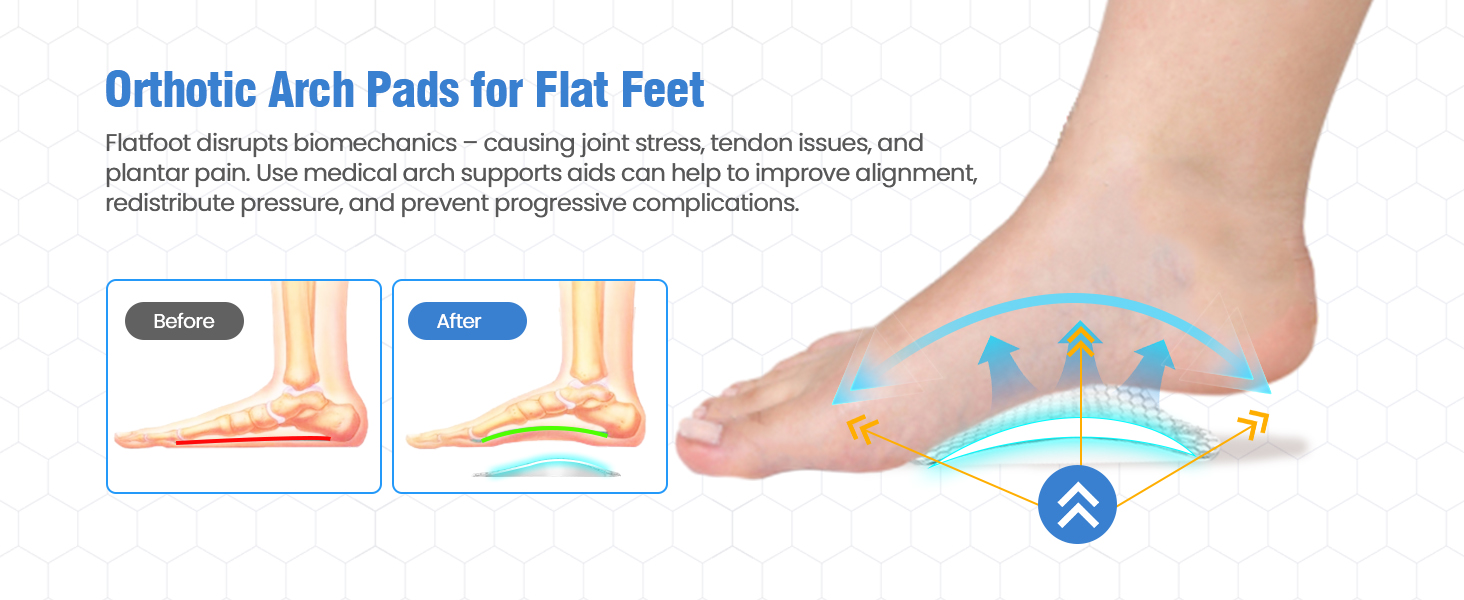arch support flats arch support pads insoles for women arch support