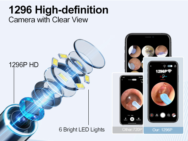 ear wax removal tool