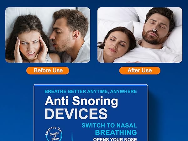 anti snoring devices