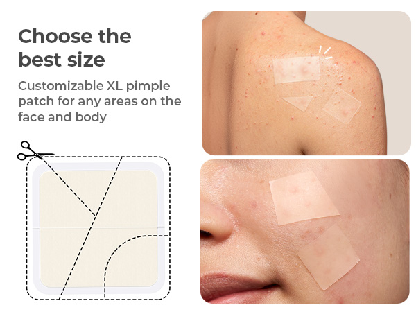 large pimple patches
