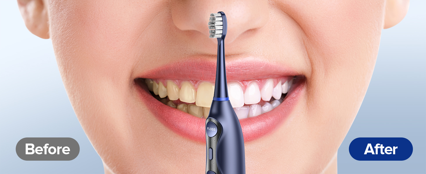 electric toothbrush with water flosser