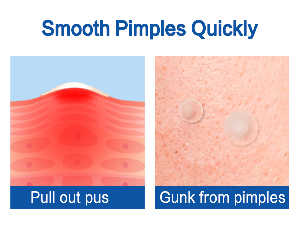 PIMPLE PATCH