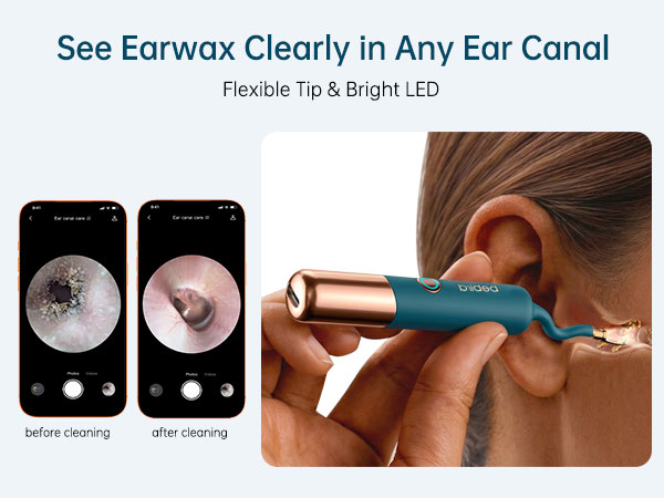 flexible ear cleaner