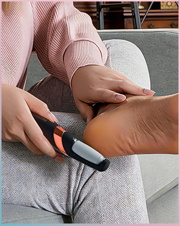 electric foot callus remover