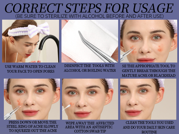 blackhead remover tools