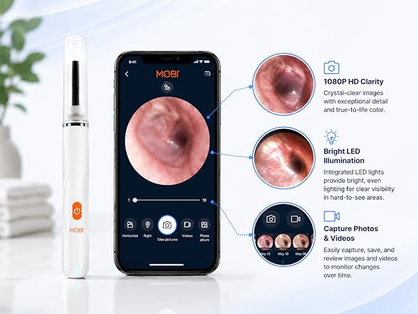 MOBI Smart Ear Camera with HD smartphone view and feature callouts for imaging and LED lighting