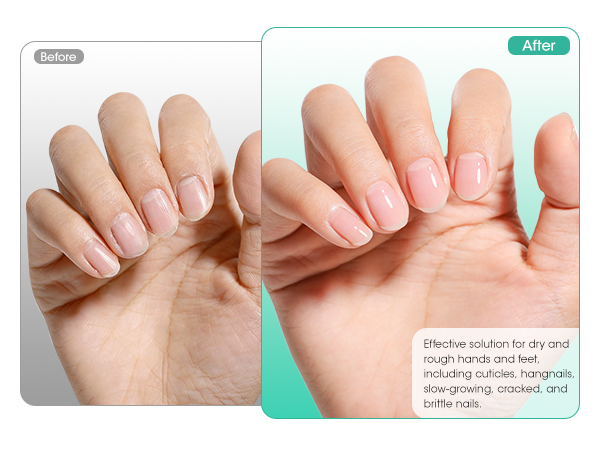 nail prep kit
