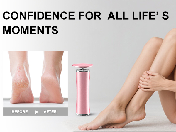 heel scraper for cracked heels