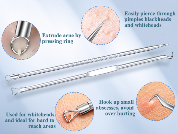 pimple popper tool