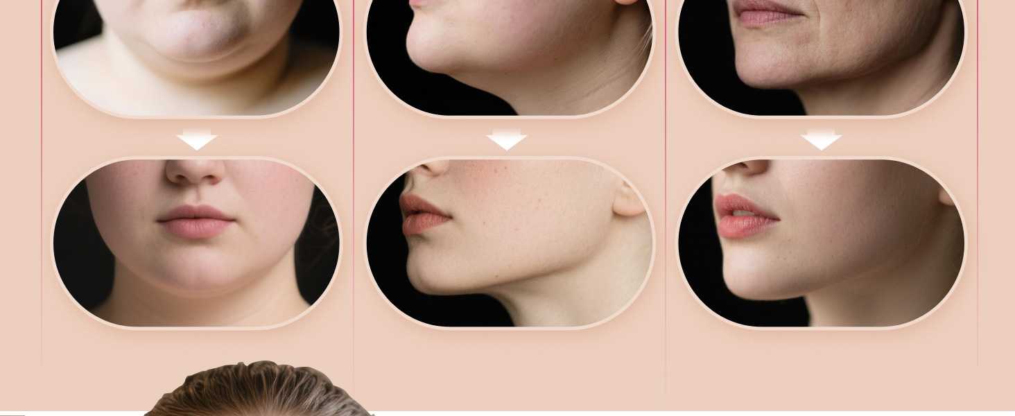 double chin reducer