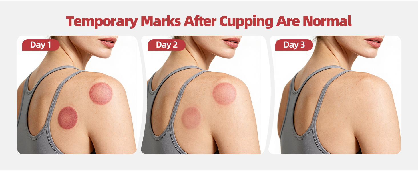 cupping massager cupping kit for massage therapy cupping therapy set cupping kit