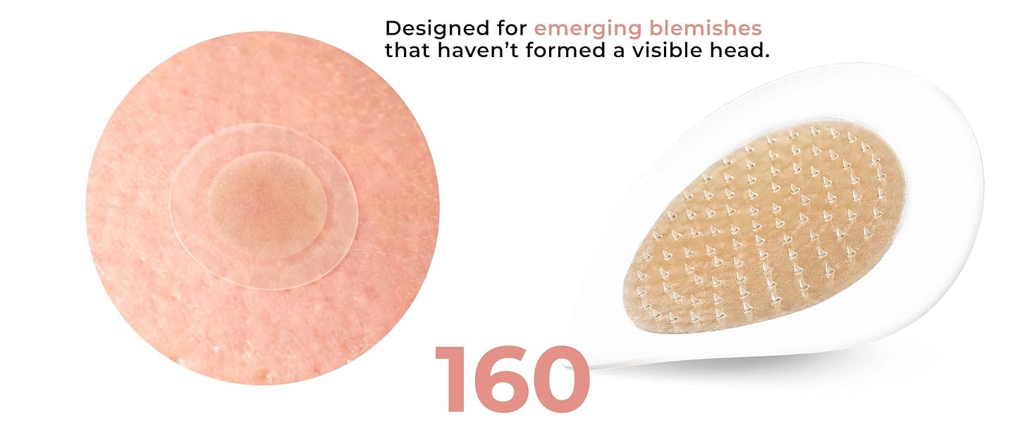 Designed for emerging blemishes that haven&amp;#39;t formed a visible head. 160