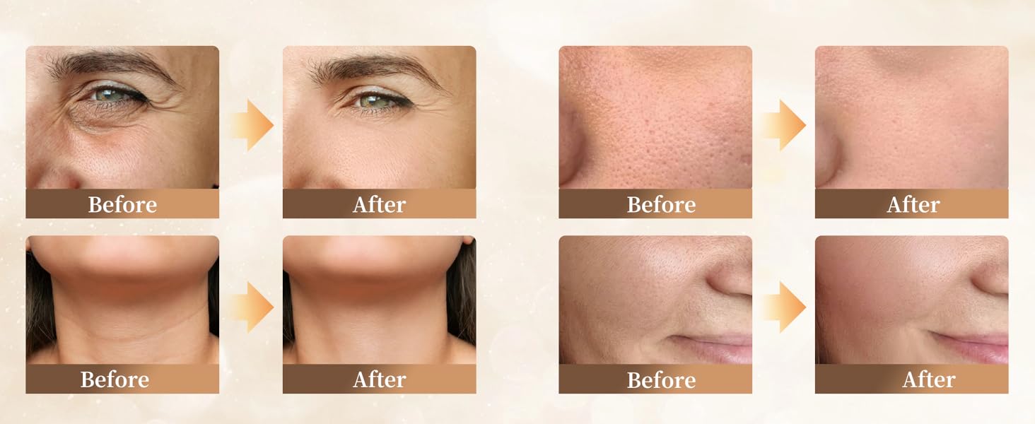 Visible before and after results showing smoother, firmer facial skin