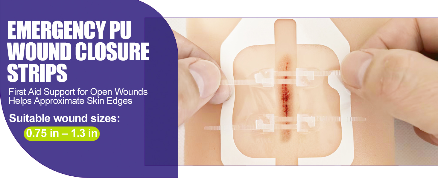 40 Pack Wound Closure Strips