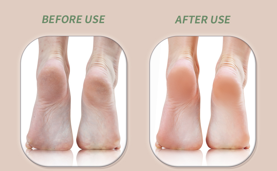 KuuCare Pumice Stone, KuuCare feet pumice, KuuCare Foot, KuuCare Foot File